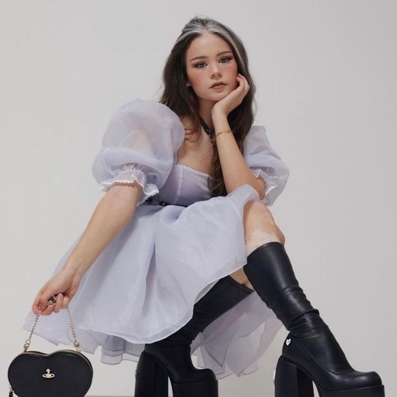 SELKIE Puff dress new with tags baby blue pinstripe free people xs - Picture 3 of 10